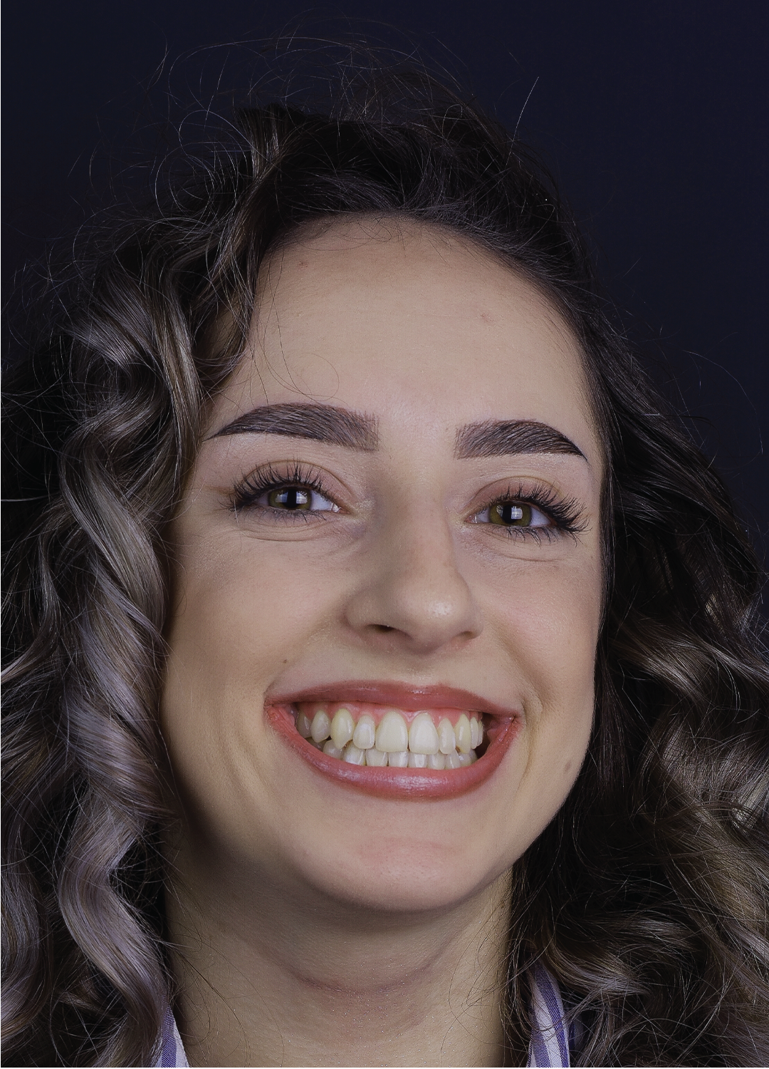 Portret pacienta dupa tratament ortodontic complet si reabilitare estetica la Orto Clinic Tas Razvan